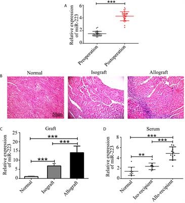 Overexpression of miR-223 Promotes Tolerogenic Properties of Dendritic Cells Involved in Heart Transplantation Tolerance by Targeting Irak1